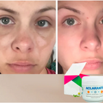 2X1 Crema Aclaradora Corporal + ENVIO GRATIS